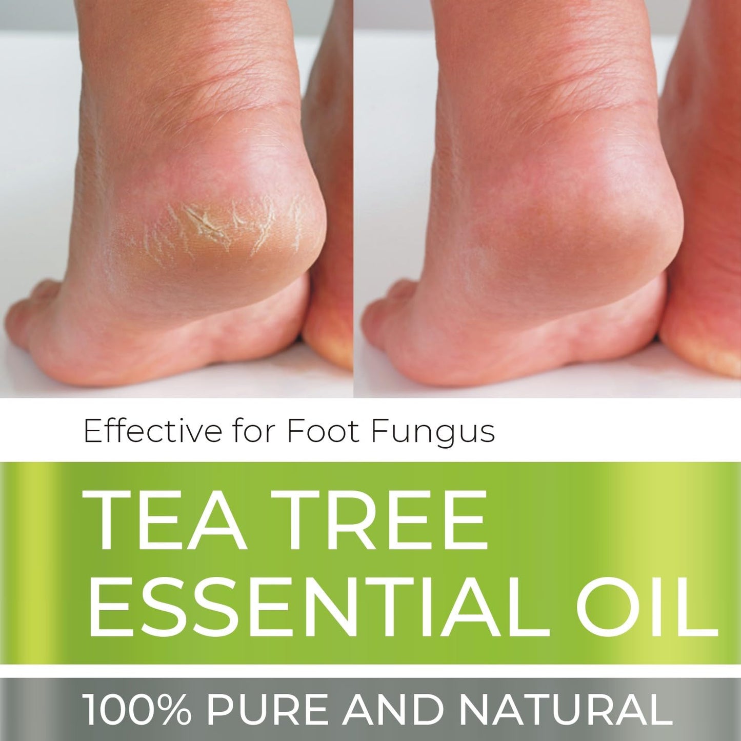 Tea Tree Essential Oil - 4 oz, 100% Pure & Natural with Glass Dropper