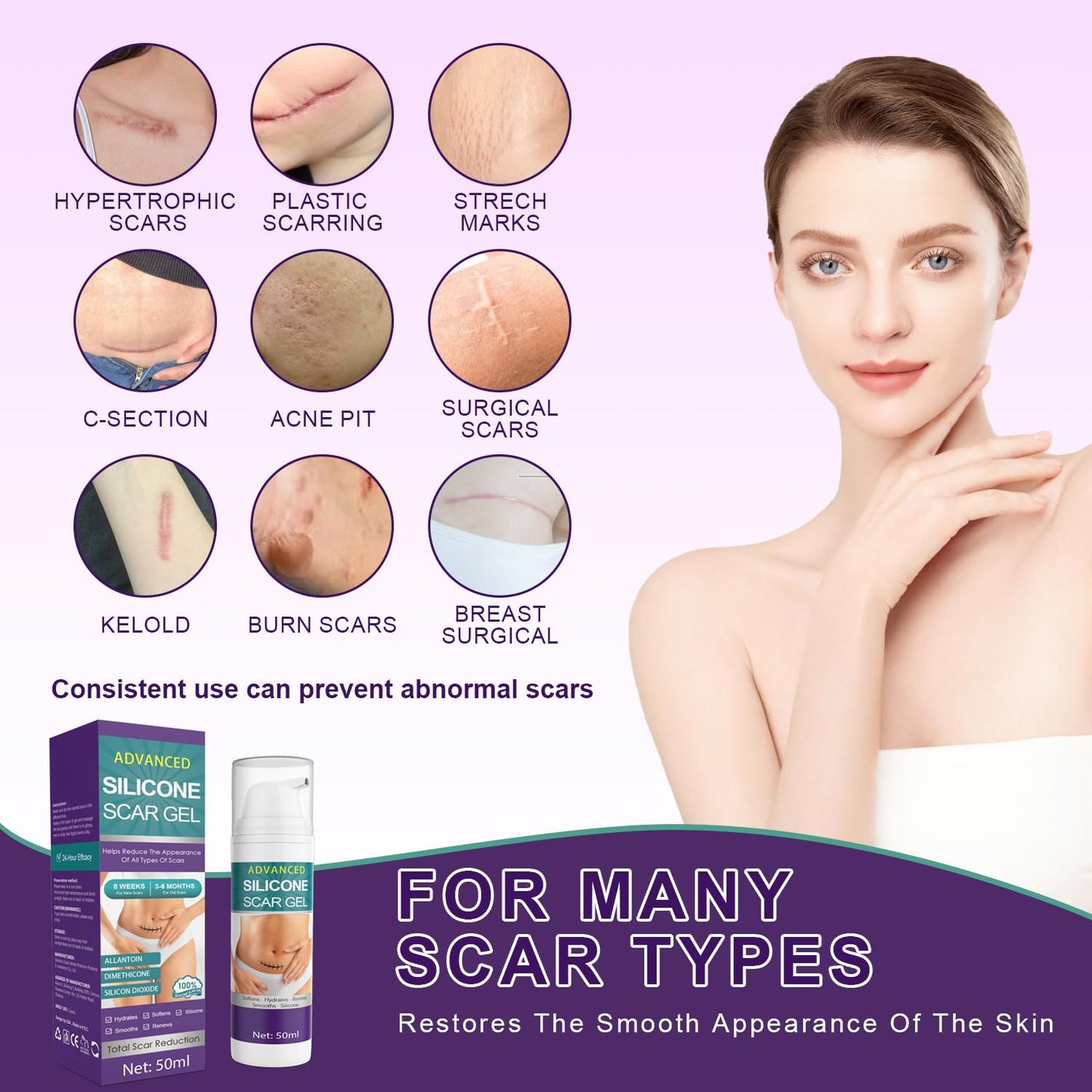 Tearich Silicone Scar Cream - Advanced Scar Gel for Scars, Stretch Marks & Burns | 1.76 oz