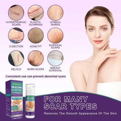 Tearich Silicone Scar Cream - Advanced Scar Gel for Scars, Stretch Marks & Burns | 1.76 oz