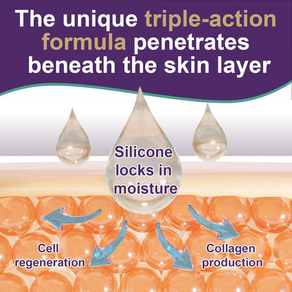 Tearich Silicone Scar Cream - Advanced Scar Gel for Scars, Stretch Marks & Burns | 1.76 oz