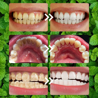Teeth Restoration Mineral Powder - Strengthen Teeth & Gums | Oral Care Mineral Powder