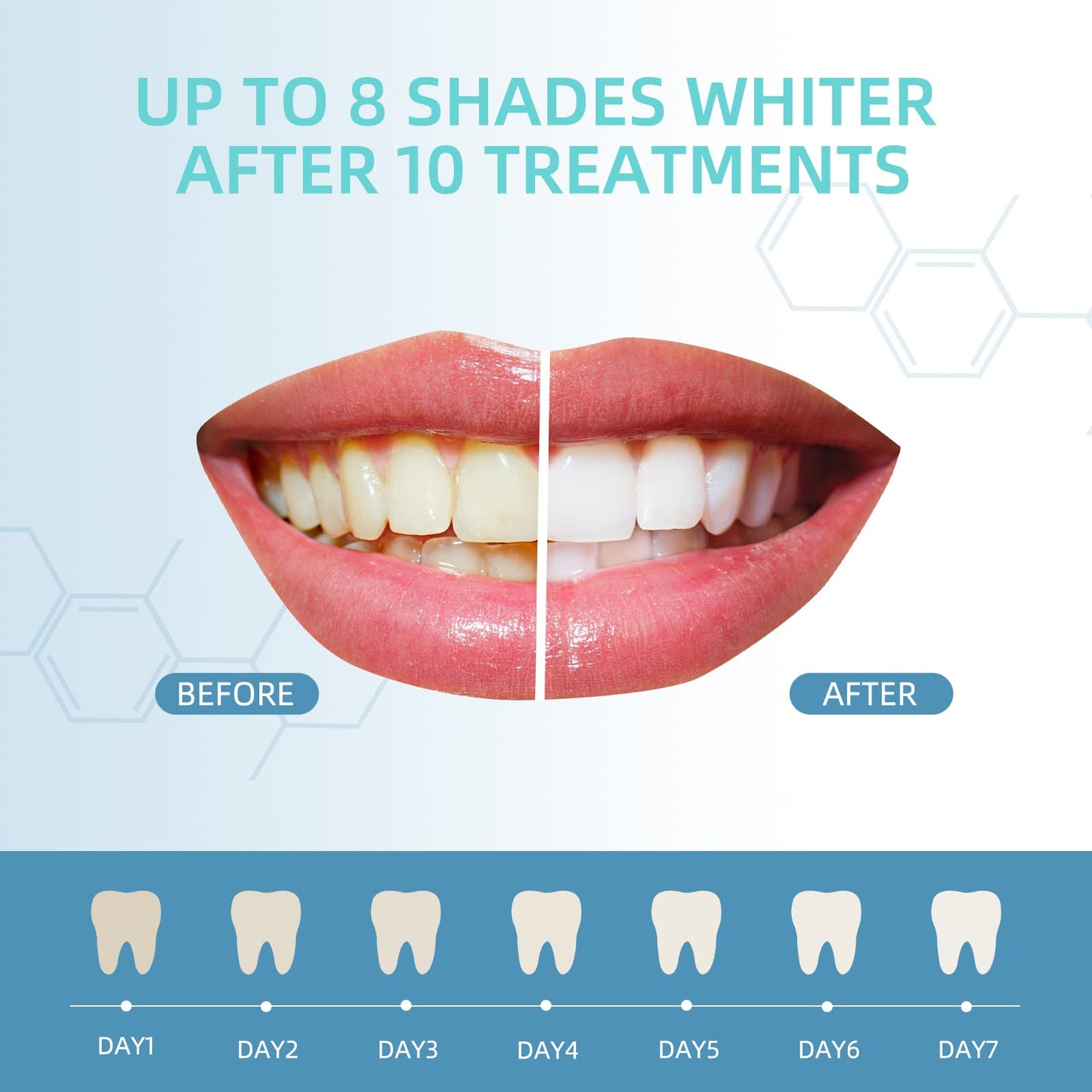 Teeth Whitening Gel Refills 10PCS – 48+ Treatments | 35% Carbamide Peroxide