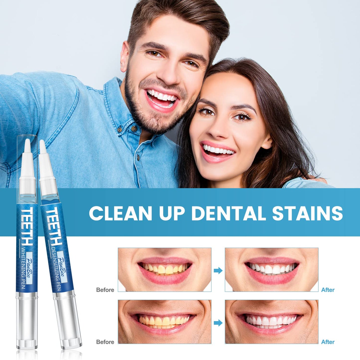 Teeth Whitening Pen 5-Pack – 70+ Treatments, 1–6 Shade Whiter in 1–2 Weeks
