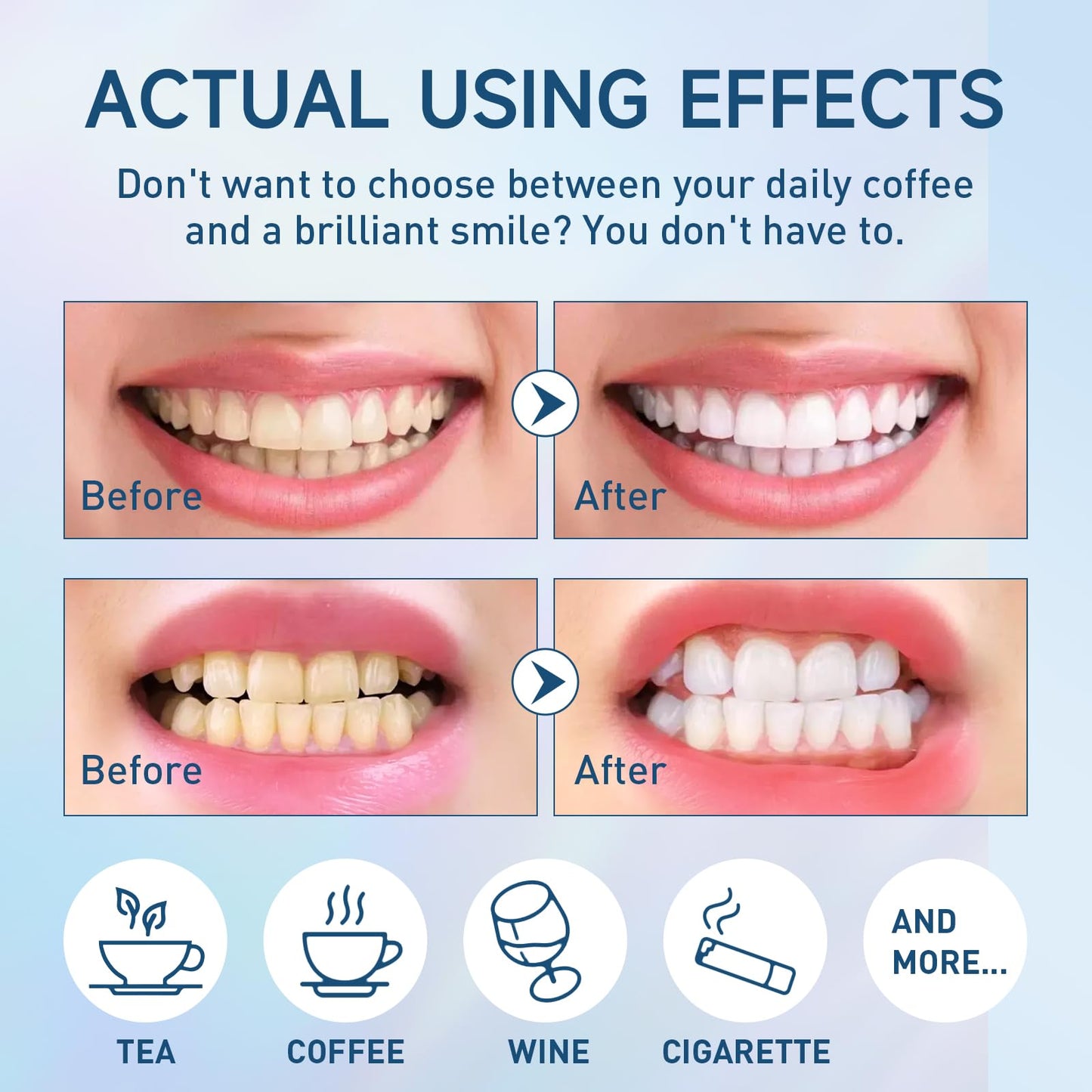 Teeth Whitening Powder – Remineralizing Mint Tooth Powder (50g / 1.76oz)