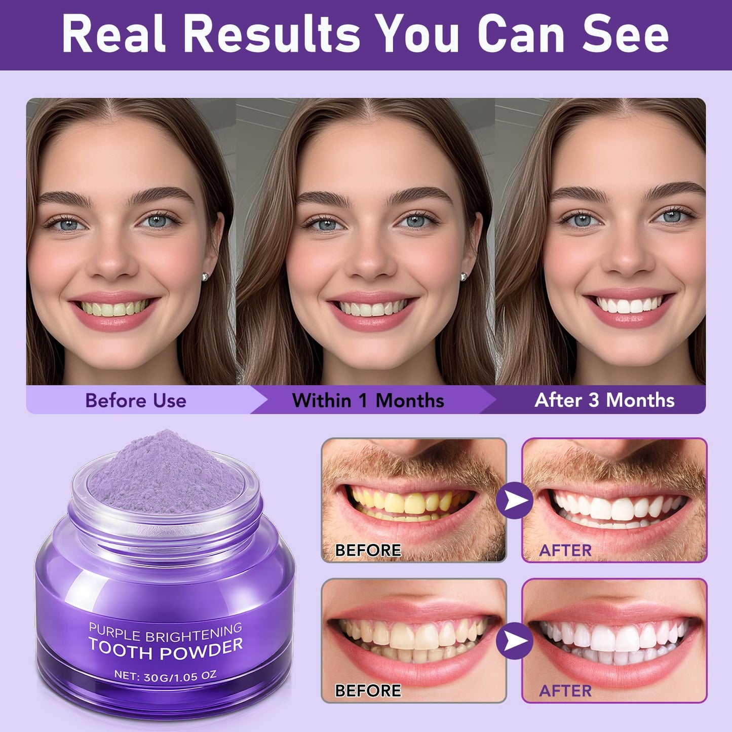 Teeth Whitening Powder - No Sensitivity & Stain Removal Booster