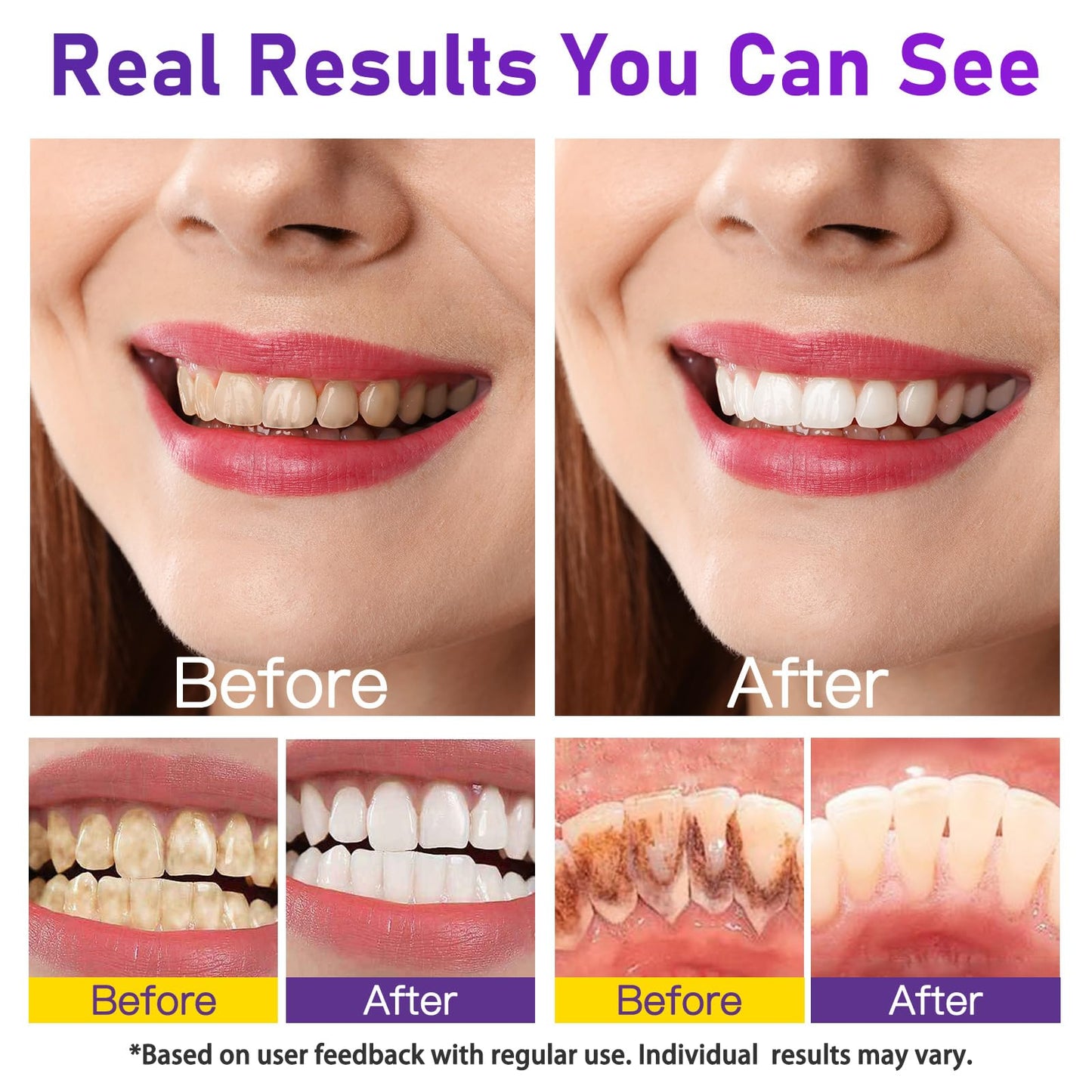 Teeth Whitening Powder 15g - Removes Stains, No Sensitivity | Coffee, Tea & Tobacco