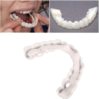 Temporary Adjustable Smile Support - 2 Pairs, Comfortable & Secure, Top & Bottom Included‌ (1)