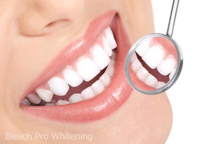 Teeth Whitening Gel Syringe Dispensers – 22% Carbamide Peroxide, 10 x 3ml Syringes