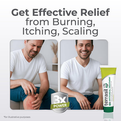 Terrasil Clotrimazole Antifungal Cream — Fast Relief for Ringworm, Jock Itch, Athlete's Foot | FSA/HSA Eligible (7oz)