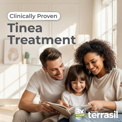 Terrasil Tinea Versicolor Treatment Cream Max Strength – 1% Clotrimazole Antifungal (7oz)