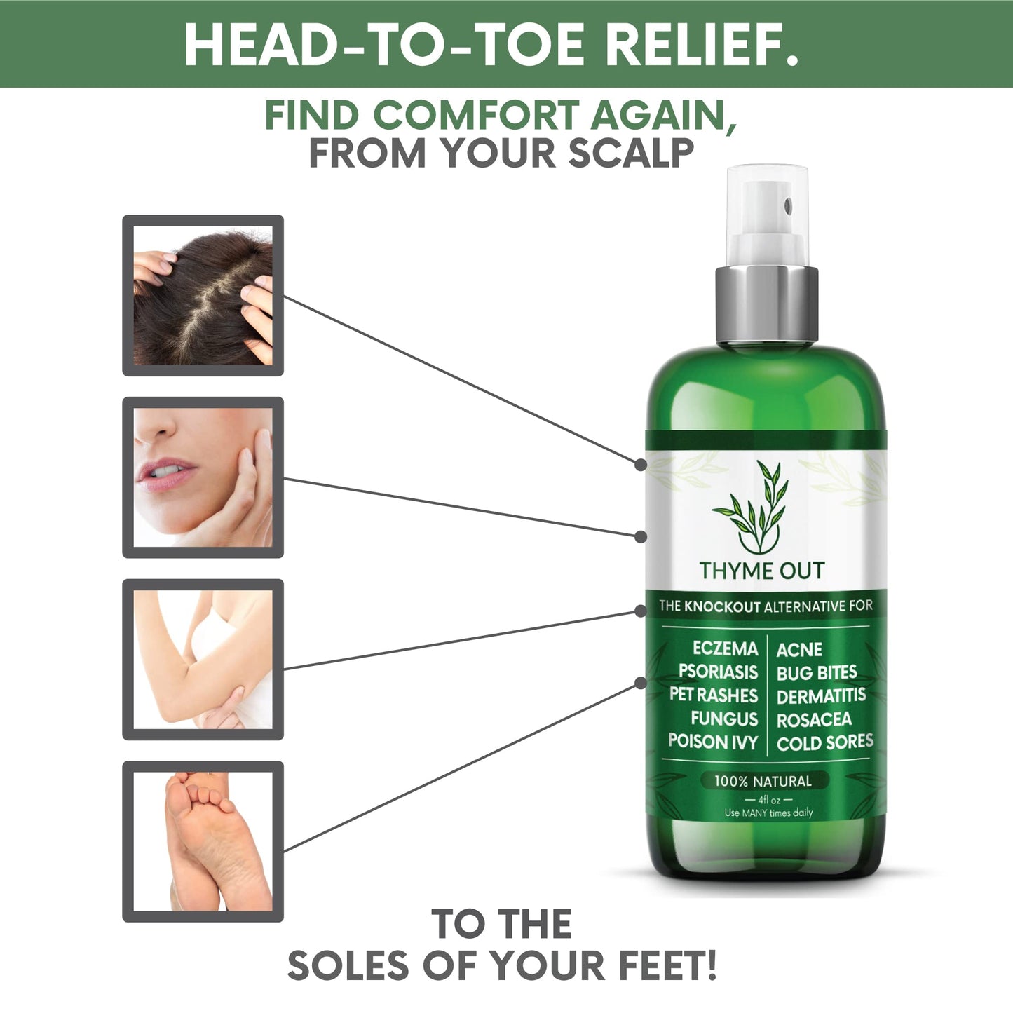 Thyme Out All Natural Eczema Treatment & Anti-Itch Spray | Acne, Psoriasis & More (4oz)