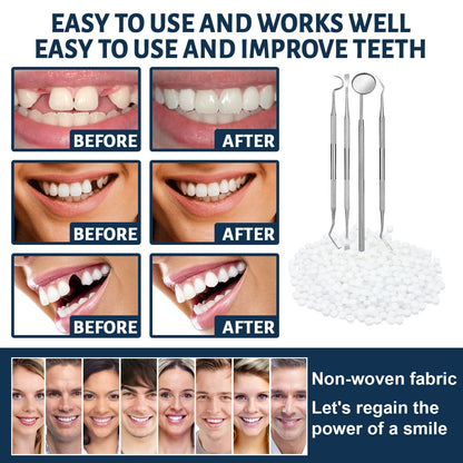 Tooth Repair Kit - Temporary Fake Teeth Replacement with Dental Mirror Tools | Ceonam