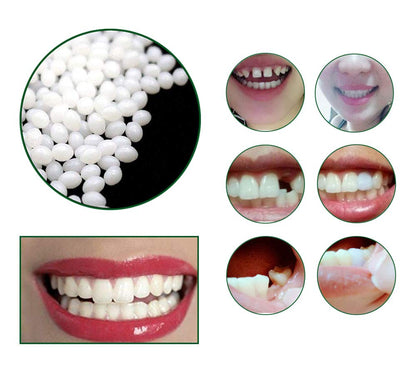Tooth Repair Kit - Instant Temporary Teeth Replacement
