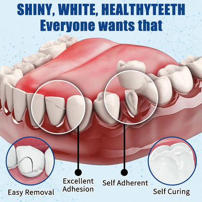 Tooth Repair Kit – Temporary Filling for Missing & Broken Teeth (Men & Women)
