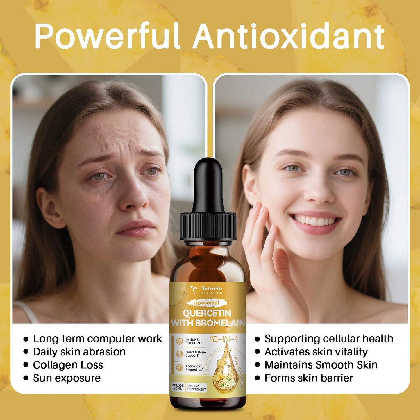 Totaria Liposomal Quercetin with Bromelain Liquid Drops - 1000mg Quercetin + 500mg Bromelain, Immune Support (2 fl oz)