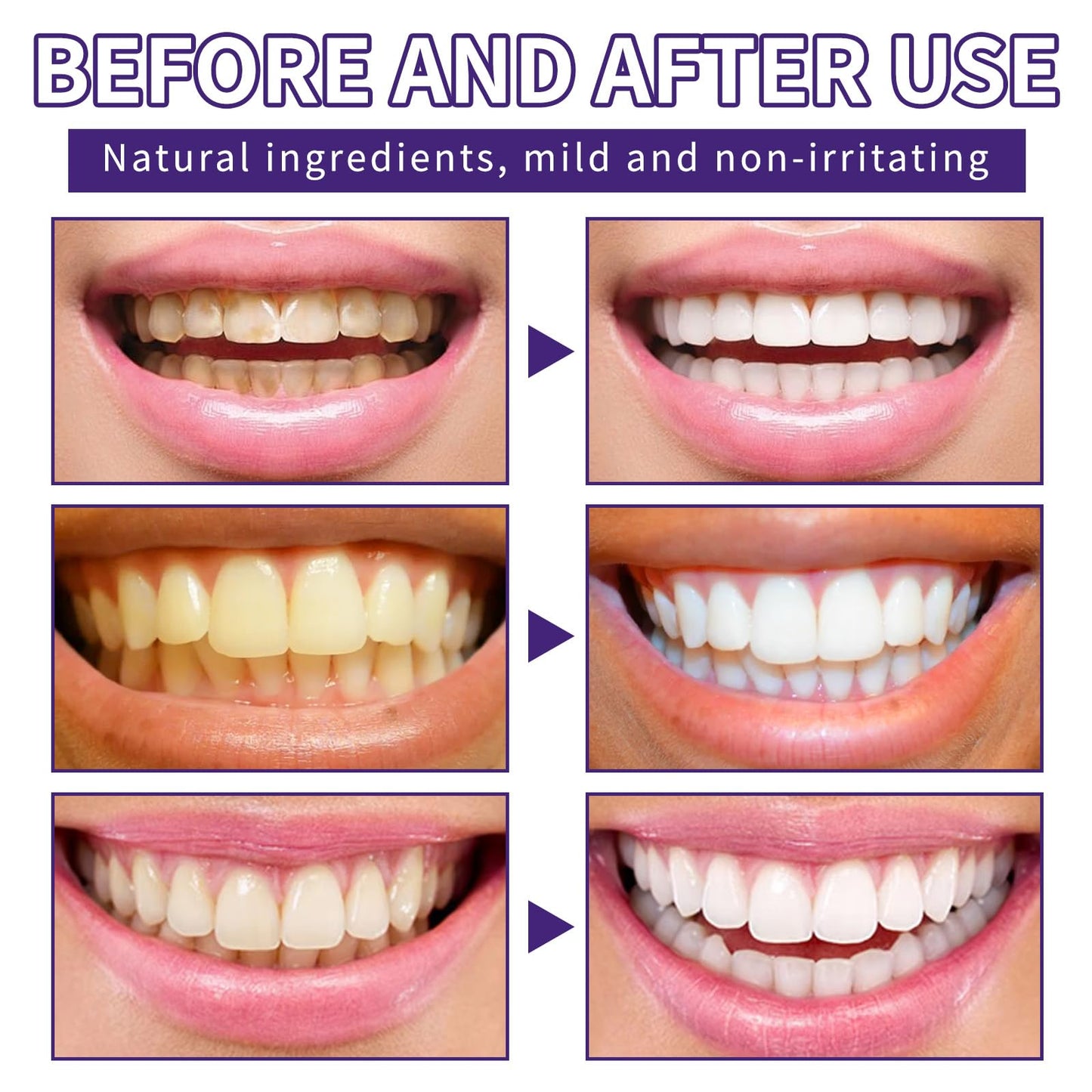 Tpyag Teeth Restoration Mineral Powder 50g – 2pcs | Strengthen Teeth & Gums
