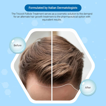 Tricovit Hair Growth Supplement | Nail & Hair Health Vitamins (60 tablets)