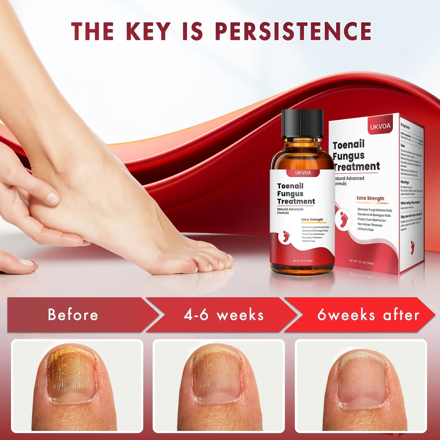 UKVOA Toenail Fungus Treatment Extra Strength Upgraded – Nail Repair for Thick, Discolored Nails