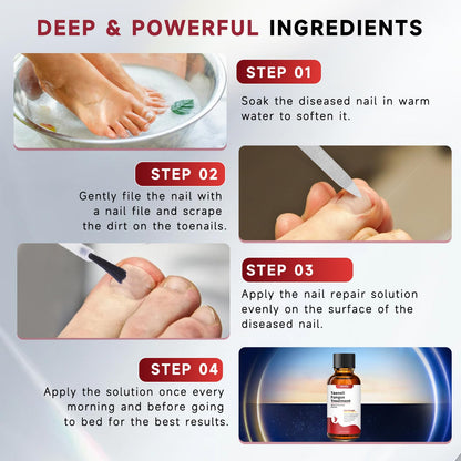 UKVOA Toenail Fungus Treatment Extra Strength Upgraded – Nail Repair for Thick, Discolored Nails