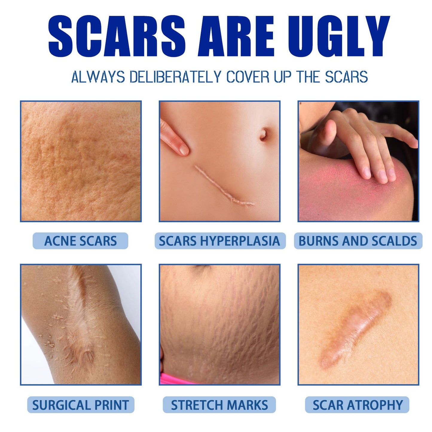 URABOS Scar Cream & Silicone Gel for Surgical Scars – Fragrance-Free, Gentle & Nourishing (1pcs)