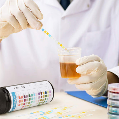 Urine Test Strips 14 Parameters – 100 Count | Fast 60s Results