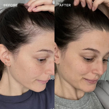 Vida Glow Marine Collagen Powder – Anti-Aging Peptides for Skin, Hair & Nails | 30 Servings, Original Flavor (Blueberry)