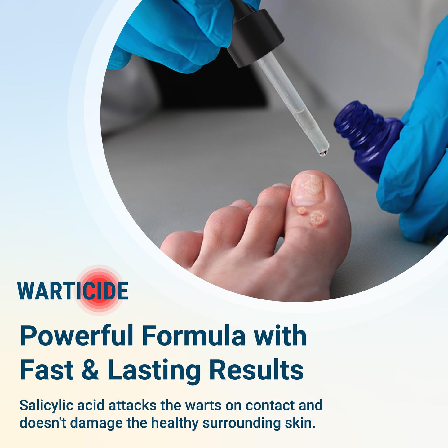 Warticide Liquid Wart Remover – 10% Salicylic Acid, Tea Tree & Cedar Leaf – Genital & Plantar Wart Treatment (USA Made) – 3-Pack