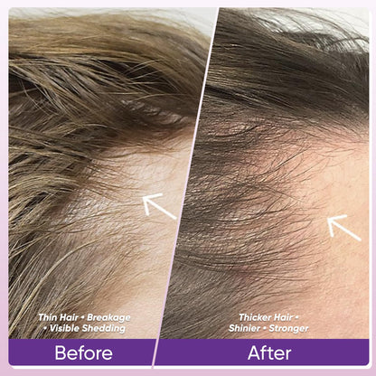 WGYPEU Hair Growth Vitamins | Biotin 10,000mcg, Collagen & Multivitamin