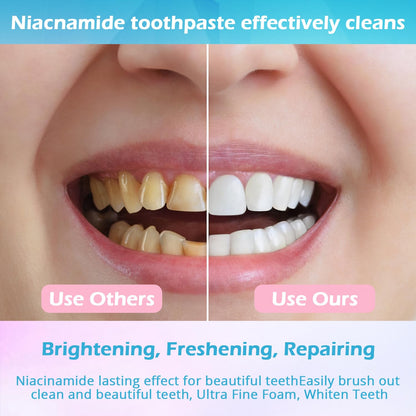 Niacinamide Whitening Toothpaste – Enamel Protection & Stain Removal (Mint) | 1 Pack | YanxiananYagao