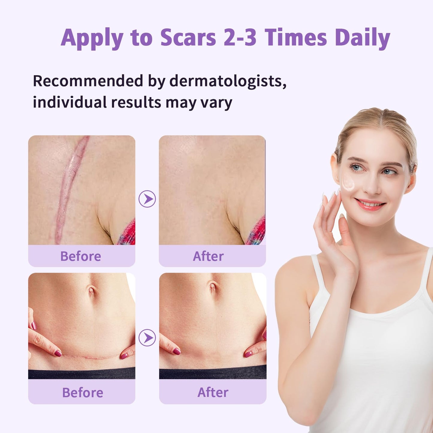 Yarster Silicone Scar Gel - Fade Scars & Stretch Marks, 1.7 oz