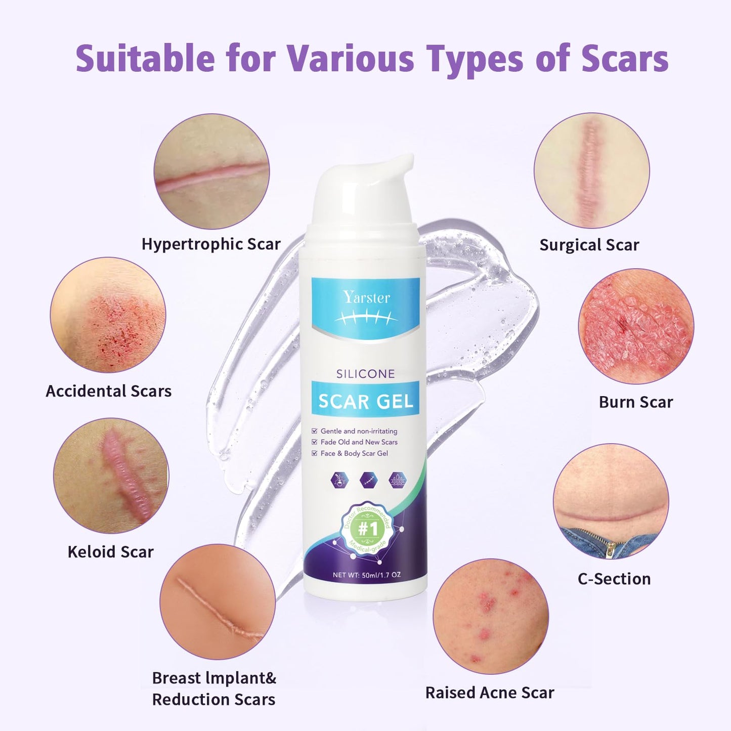 Yarster Silicone Scar Gel - Fade Scars & Stretch Marks, 1.7 oz
