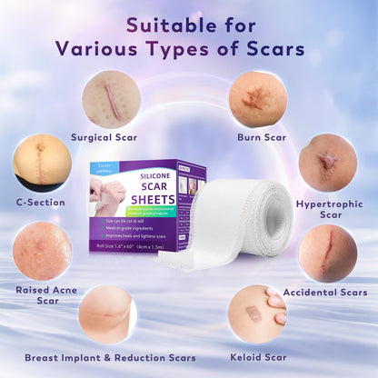 Yarster Silicone Scar Sheets | Medical-Grade Scar Tape 1.6 x 60 in