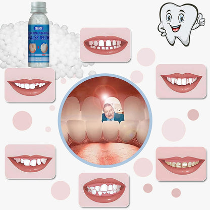 Yuehao Temporary Tooth Repair Kit – DIY Play Dough, Safe Dental Restoration, 30ml Bottle