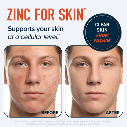Zinc Supplement Microbeadlets for Immune & Acne Support | Highly Absorbable Zinc Bisglycinate & Orotate with 2mg Chelated Copper + Vitamin B6 | Vegan, Gluten-Free | 60 Capsules (2 Month Supply)