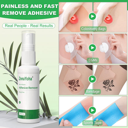 ZnnaYoha Adhesive Remover Spray – Gentle, Alcohol-Free 1oz/30ml