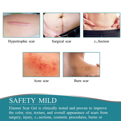 ZODENIS Medical Grade Silicone Scar Tape – 1.6” x 60” Scar Sheets (6–8 Month Supply)