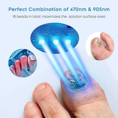 ZZP Nail Fungus Device for Multiple Nails – Home Use, 18-LED, 470/905nm